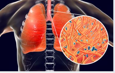 RS registra primeira morte por coqueluche em 2025